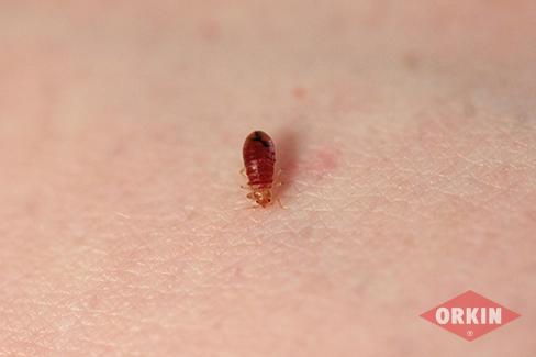 Bed Bug On Skin